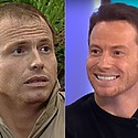 Joe Swash Hair Transplant: Everything You Need To Know