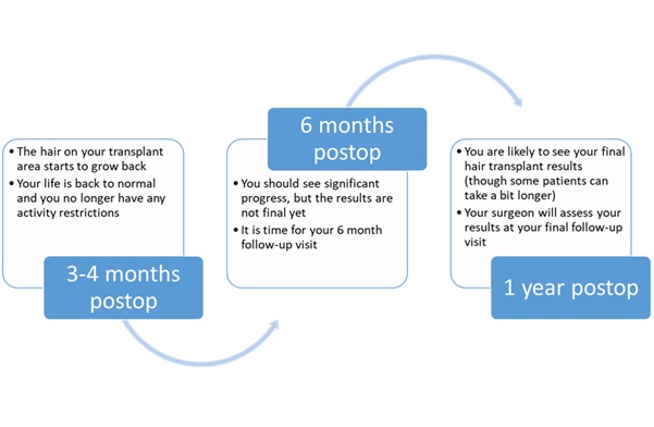 What to expect post-hair transplant surgery