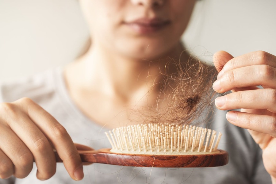 Hair Thinning