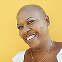 Types Of Alopecia: Causes, Symptoms, Treatments