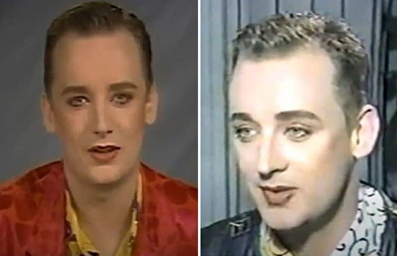 Boy George's early hair loss