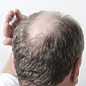 DHT Creams For Hair Growth: Do They Work?