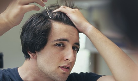 Minoxidil Timeline: How Long Does Minoxidil Take To Work?