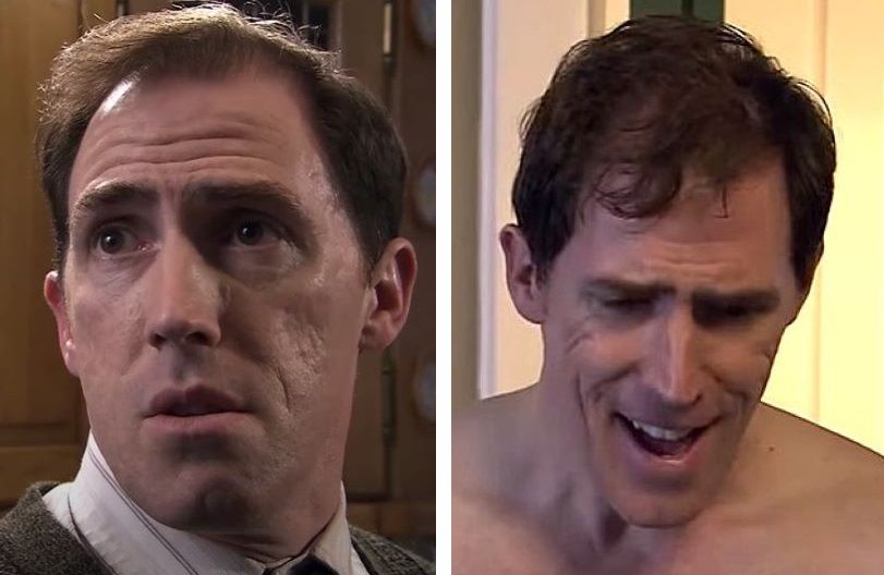 Rob Brydon's hair in Gavin and Stacey