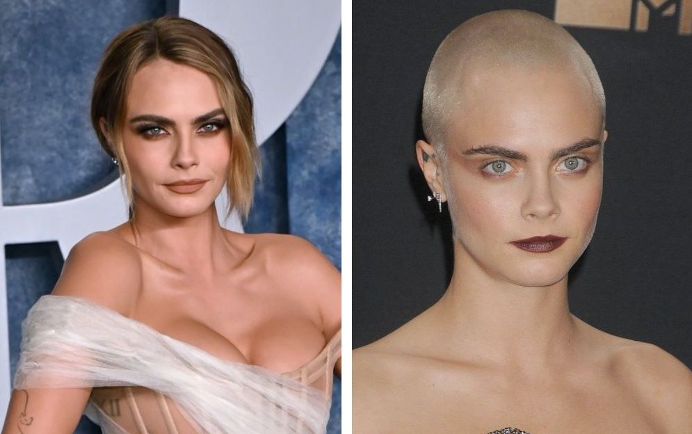 Cara Delevingne with hair (left) and bald (right)