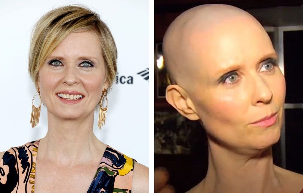 Cynthia Nixon with hair (left) and bald (right)