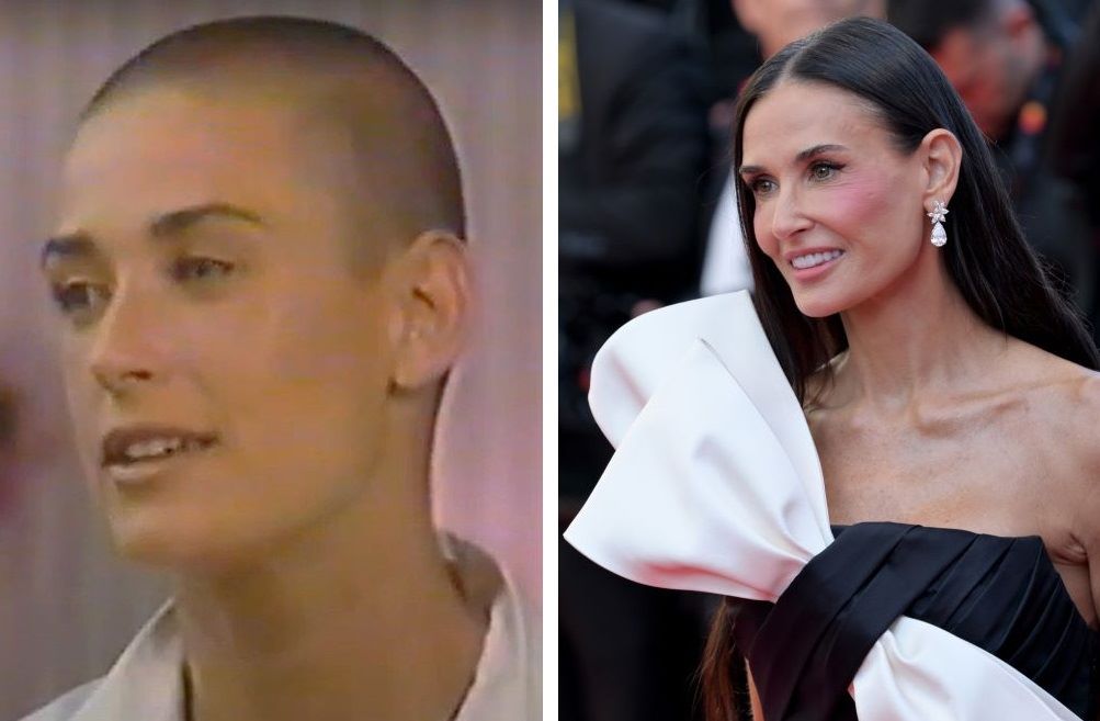 Demi Moore bald (left) and with hair (right)