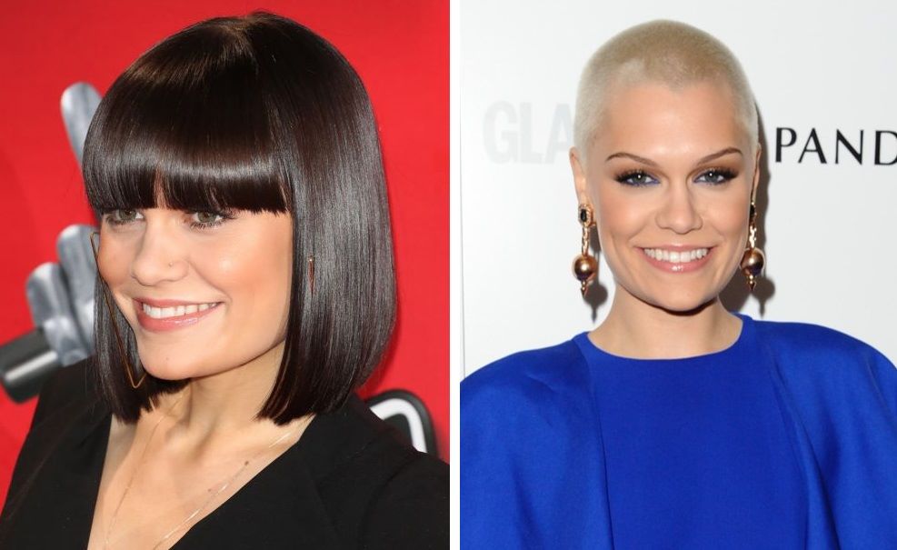 Jessie J with hair (left) and bald (right)