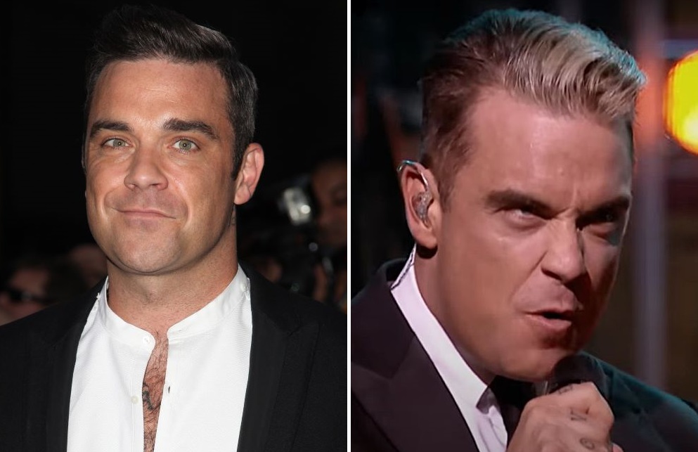 Robbie Williams' hair in 2012 (left) and in 2014 (right)