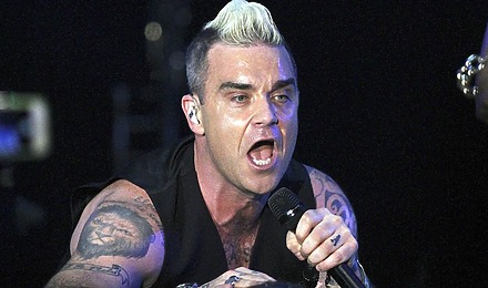 Robbie Williams Hair Transplant