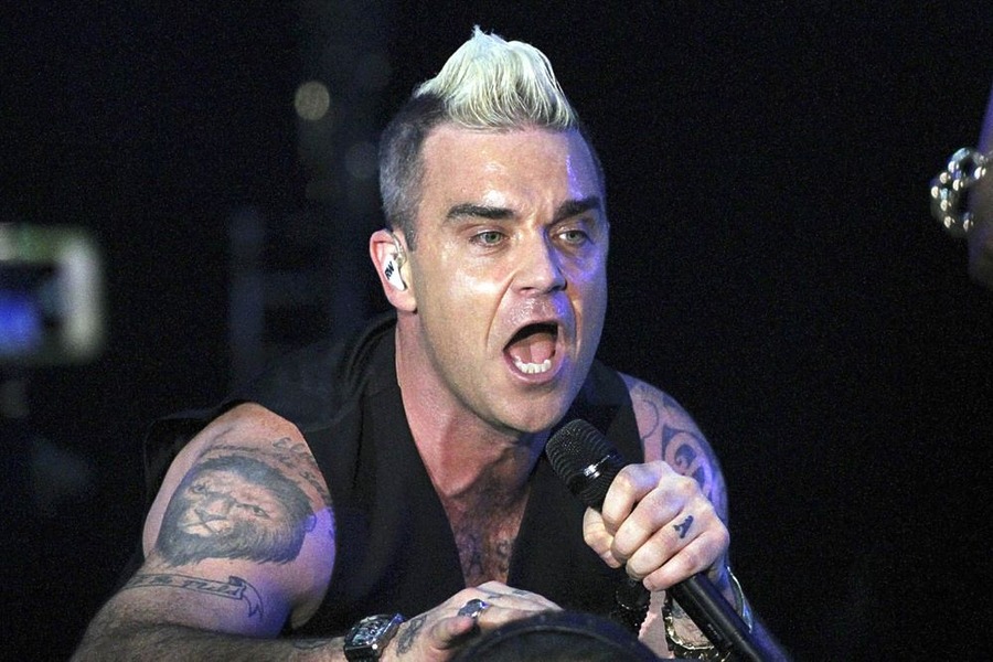 Robbie Williams Hair Transplant