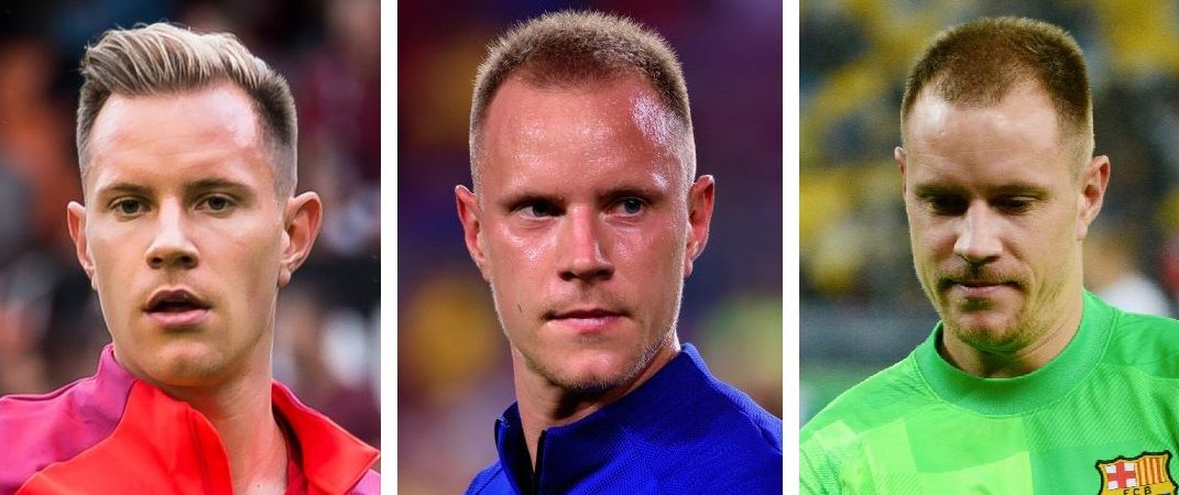 Marc Andre ter Stegen's progressively growing receding hairline