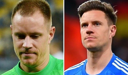 Marc Andre Ter Stegen Hair Transplant