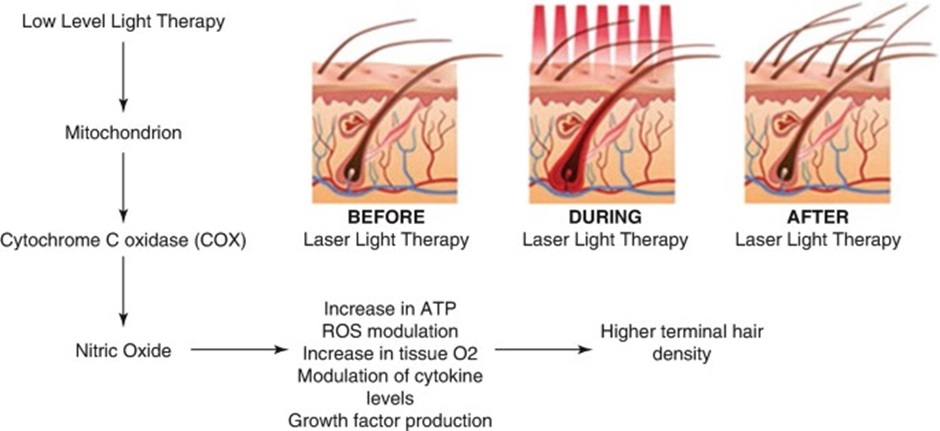 Red light therapy for hair growth mechanism of action
