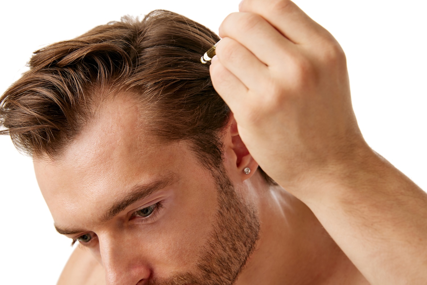 man applying hair loss treatment