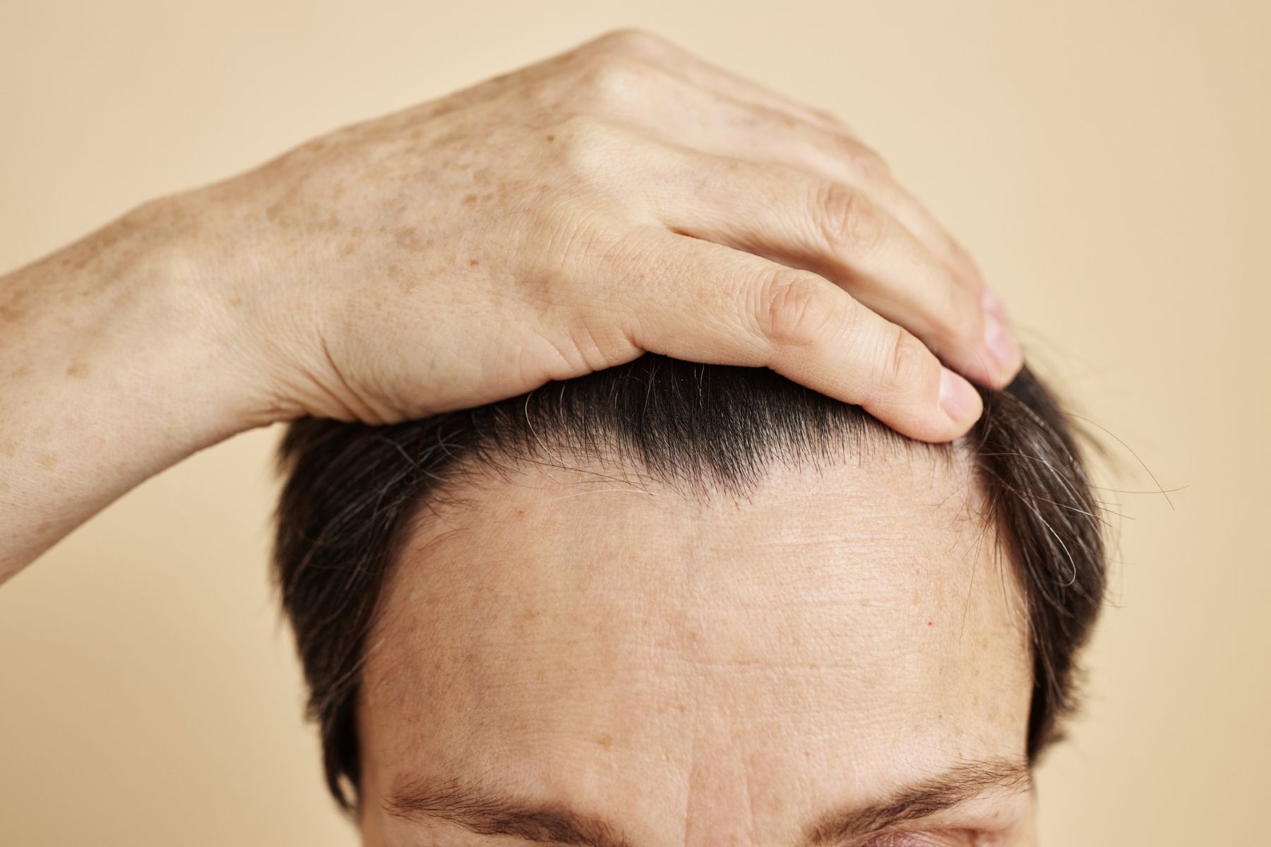 man with a receding hairline