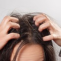 12 Reasons Your Scalp Itches A Day After Washing And How To Treat Them