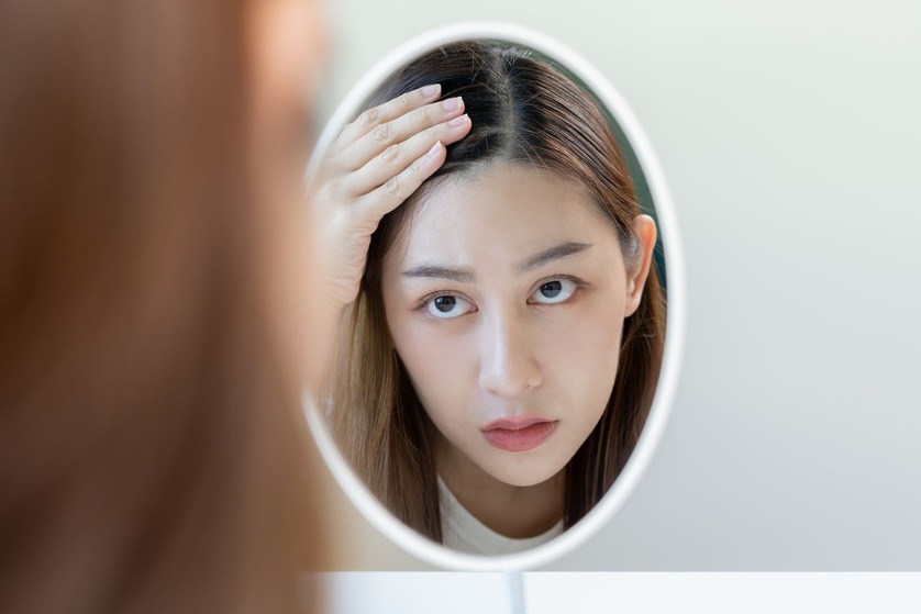 Can a Dry Scalp Cause Hair Loss? Prevention & Treatment Tips