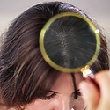 Can A Dry Scalp Cause Hair Loss? Prevention & Treatment Tips
