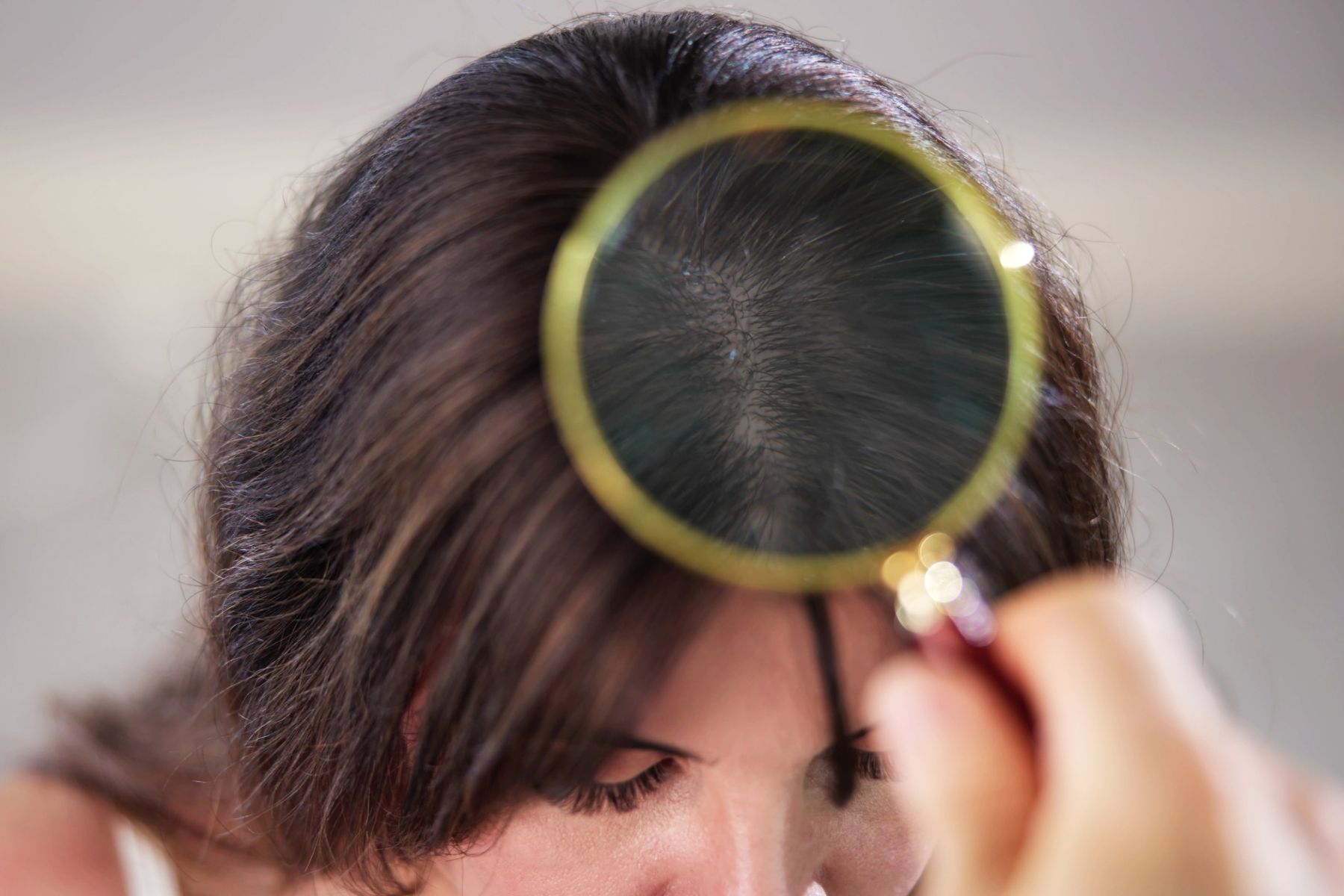 can a dry scalp cause hair loss