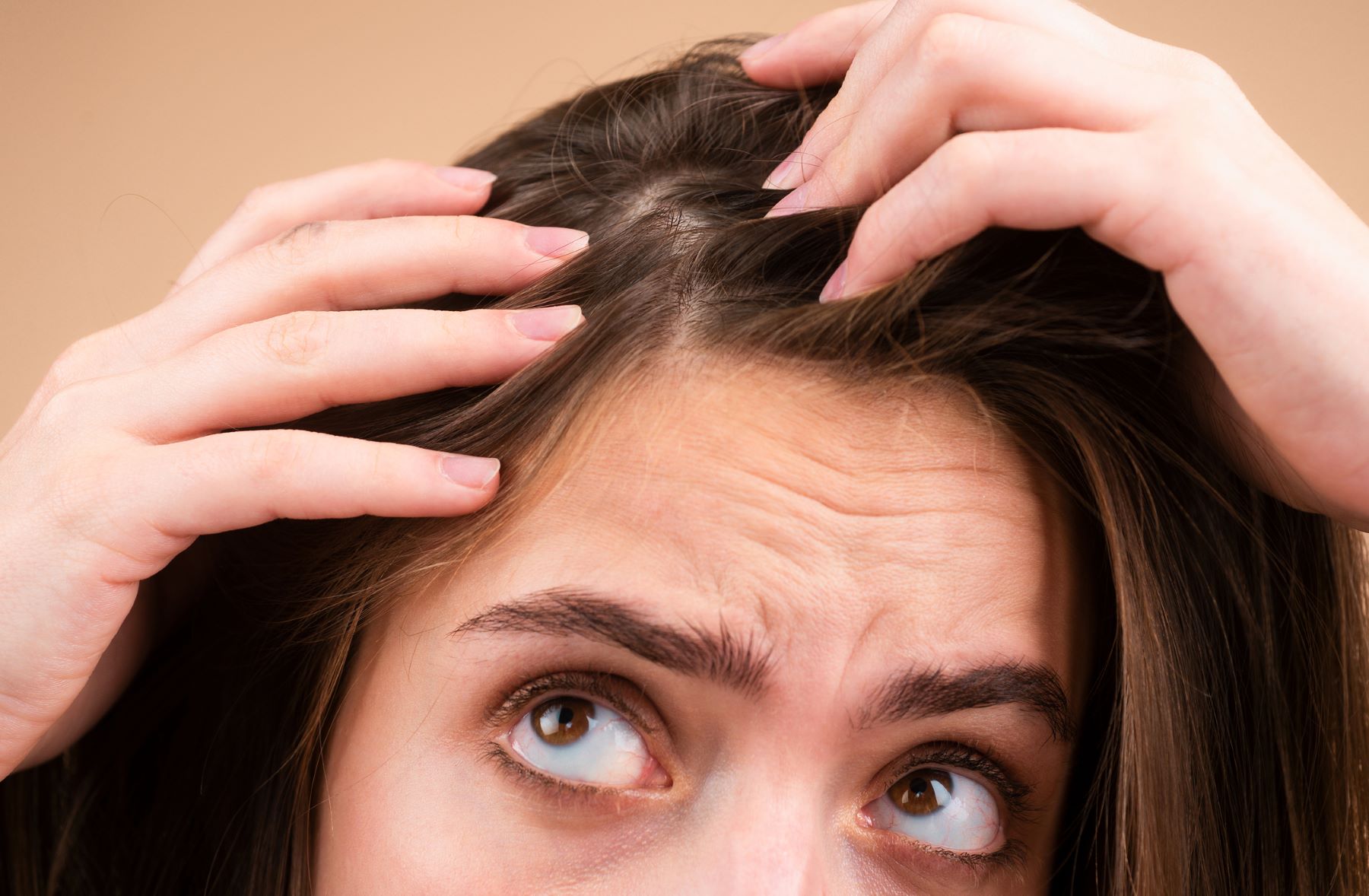 woman wondering if hair loss from a dry scalp will gro