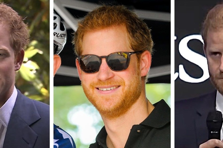 Prince Harry’s Hair Transplant - Everything You Need To Know