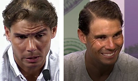 Rafael Nadal Hair Transplant Featured Image