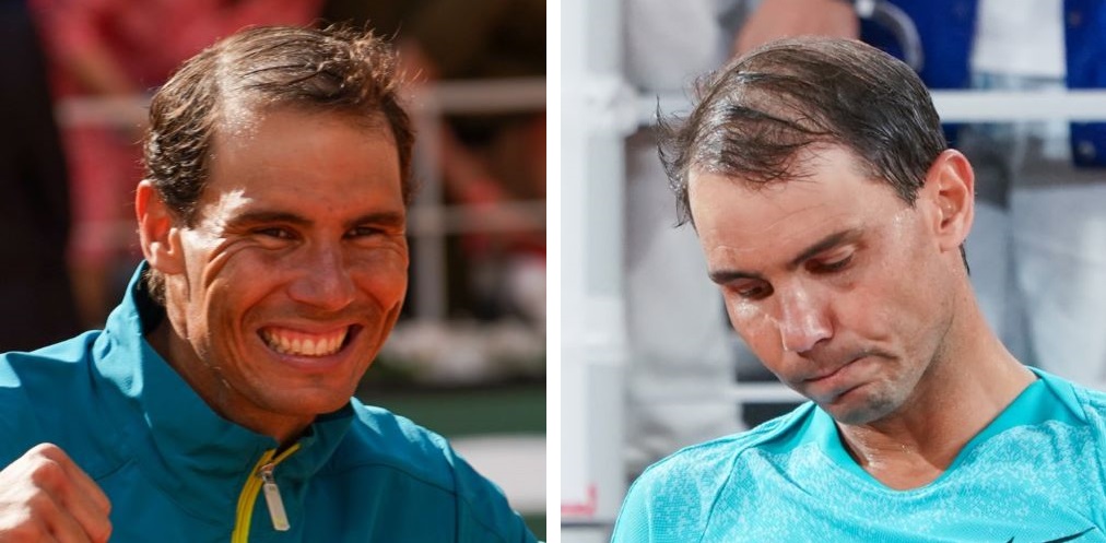 Rafael Nadal in 2022 (left) and 2024 (right)