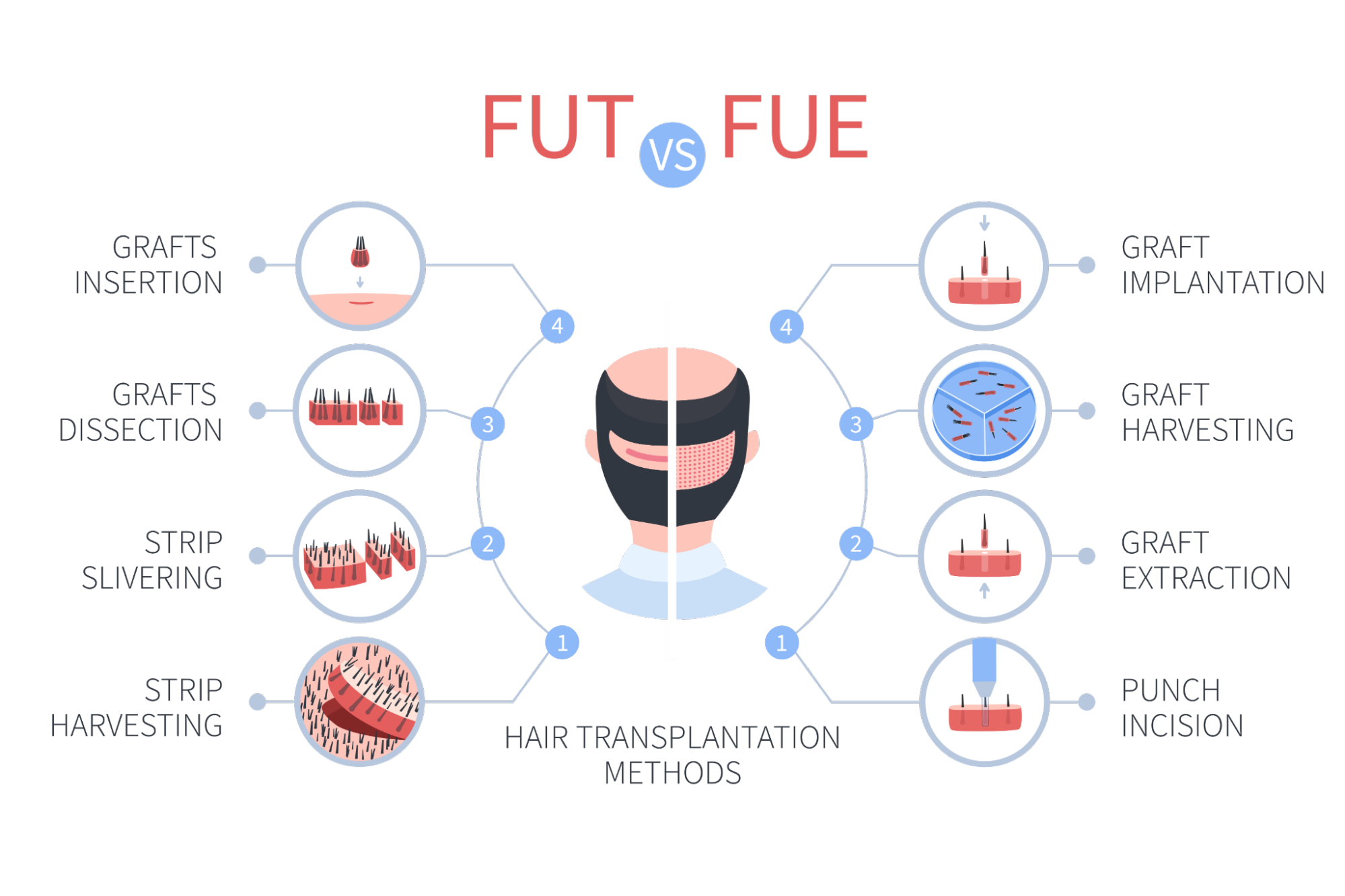The difference between FUE vs FUT hair transplants informational graphic