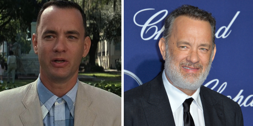 Tom Hanks hair transplant featured image