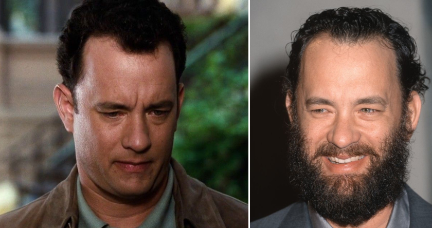 Tom Hanks’ Hair Transplant: Everything You Need to Know, Wimpole Clinic