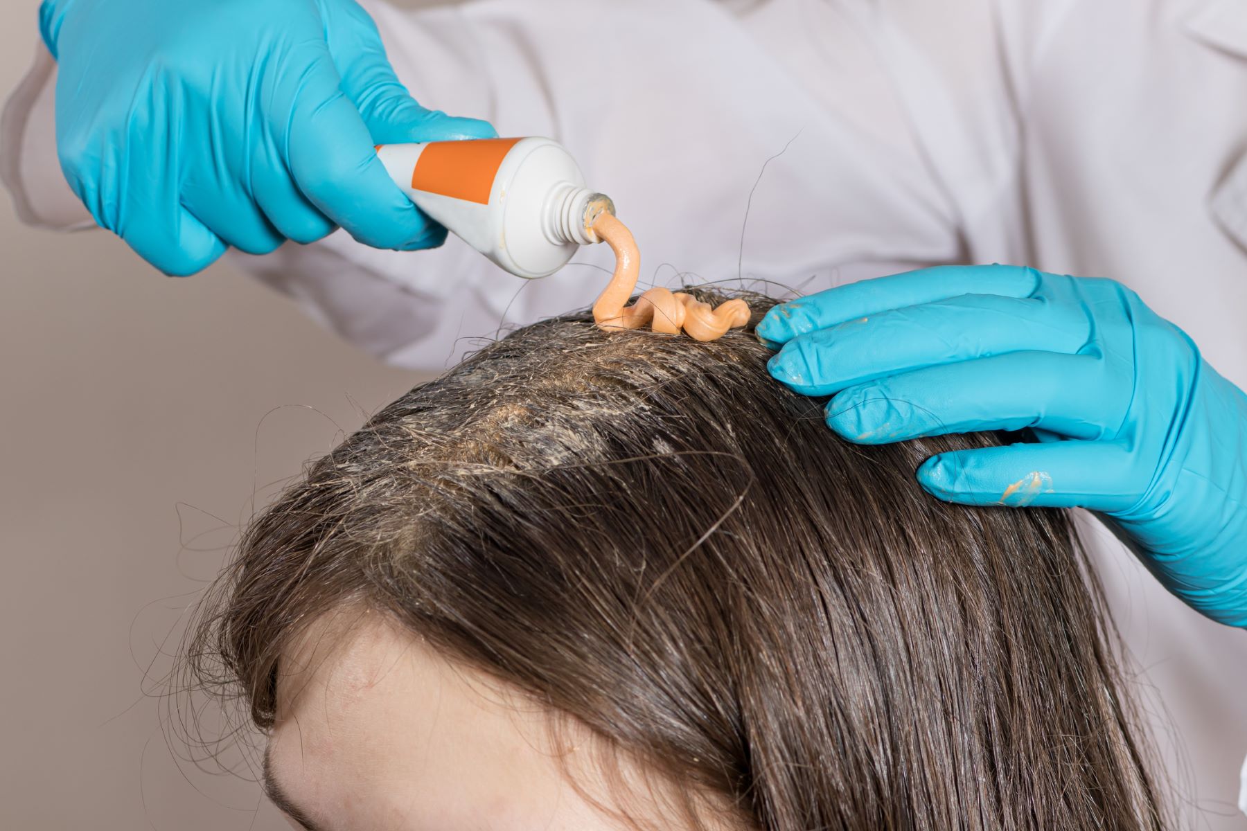 Woman getting evidence-based treatment for hair growth