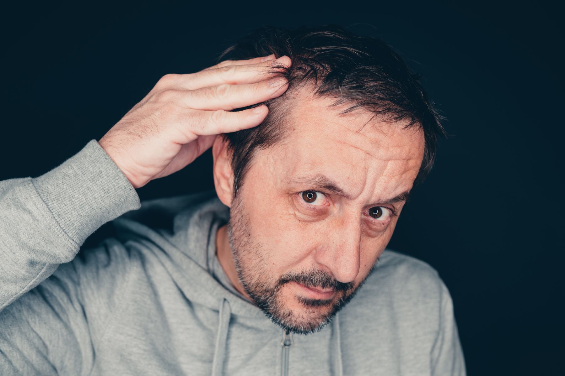 man worried about hair loss
