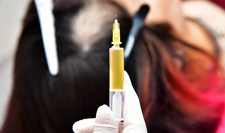 Steroid Injections For Hair Loss Featured Image
