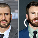 Chris Evans’ Hair Transplant – Everything You Need To Know