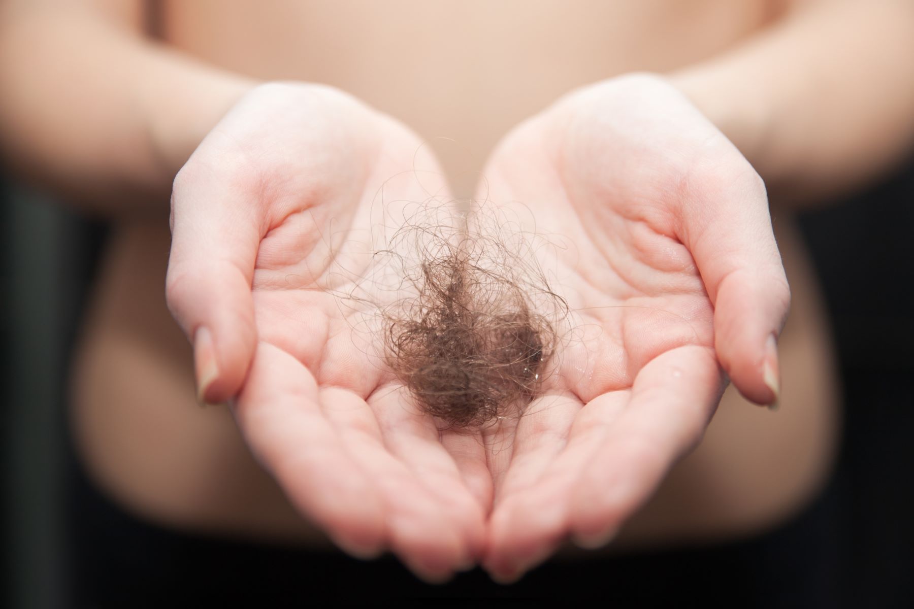 Do steroid injections cause hair loss?