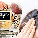 Does Vitamin B12 Deficiency Cause Hair Loss Or Is It A Myth?