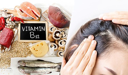 Does Vitamin B12 Deficiency Cause Hair Loss? Expert Review 2024