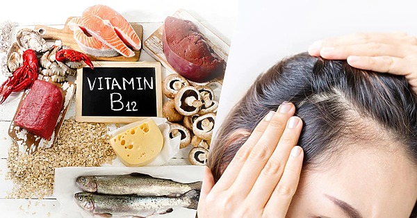 Does Vitamin B12 Deficiency Cause Hair Loss? Expert Review 2024