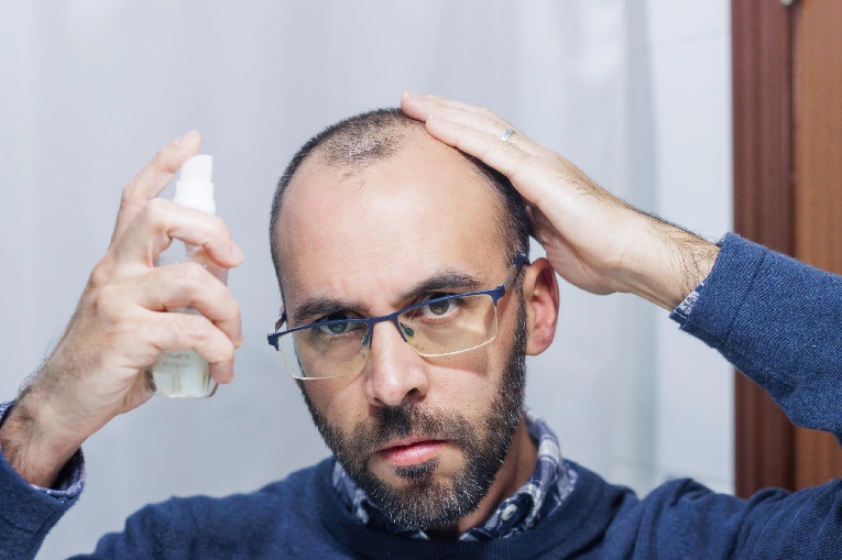 How do I relieve itching after a hair transplant?