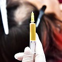 Steroid Injections For Hair Loss: Effectiveness, Risks & Benefits