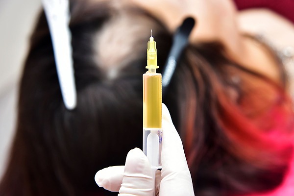 Steroid Injections For Hair Loss: Effectiveness, Risks & Benefits