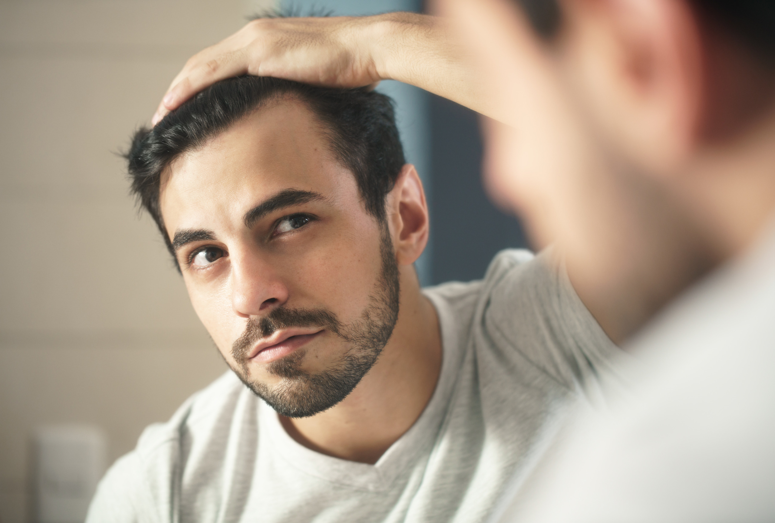 man examining his hairline