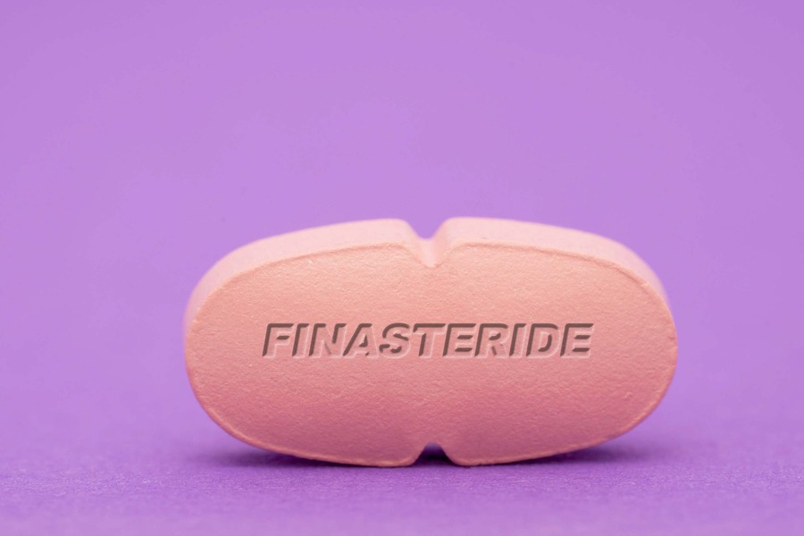 Are Finasteride Side Effects Permanent - Review