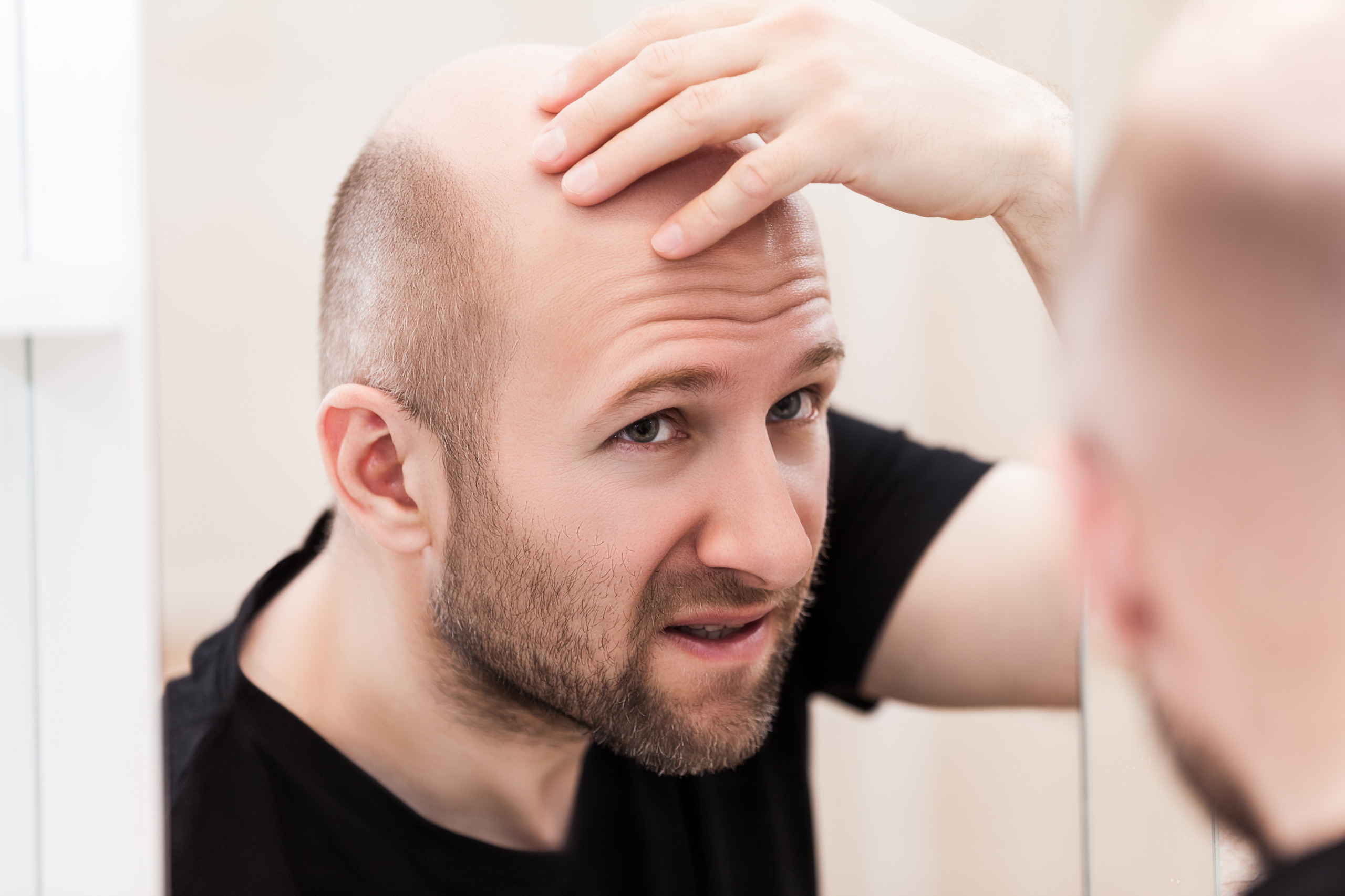Effective Ways to Reduce the Side Effects of Finasteride