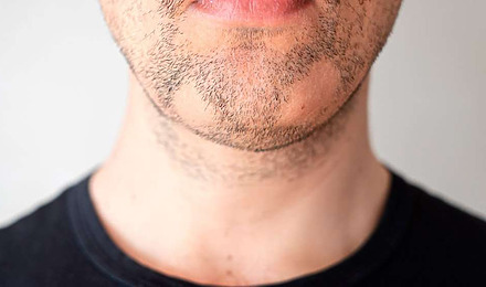 7 Reasons You May Be Growing A Patchy Beard And How To Fix It
