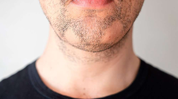 7 Reasons You May Be Growing a Patchy Beard and How to Fix It