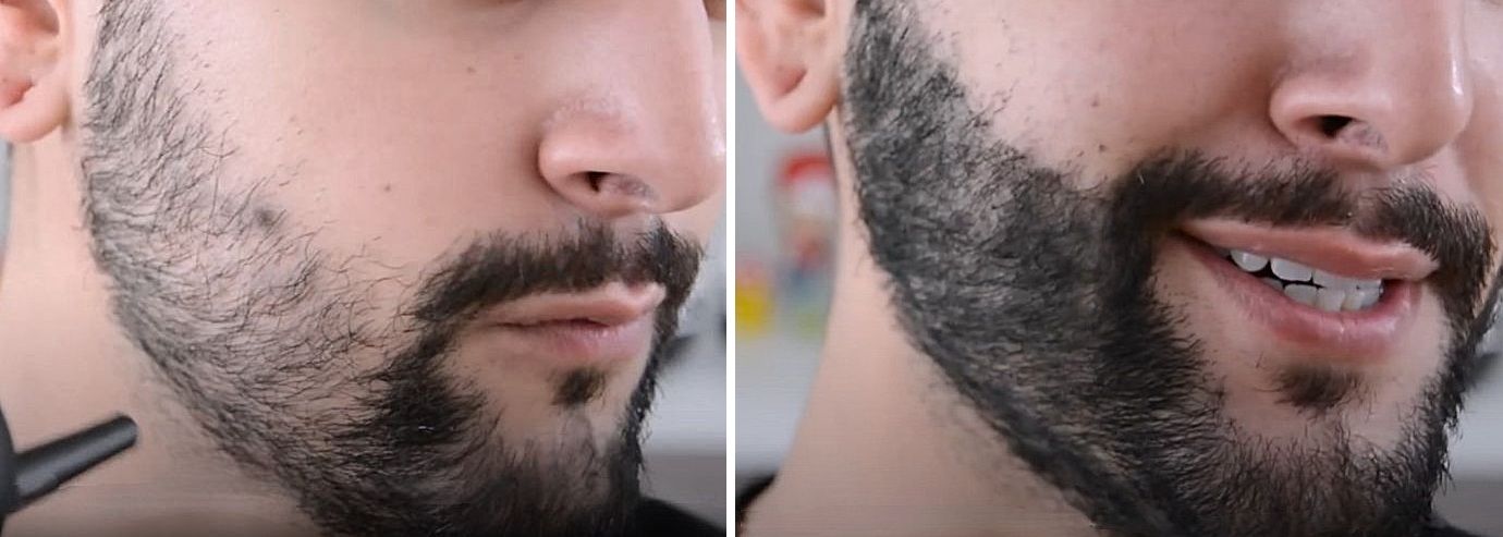 Before and after using beard thickening spray