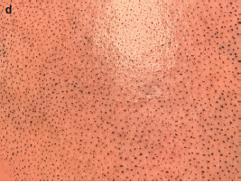 Close-up image of SMP dots