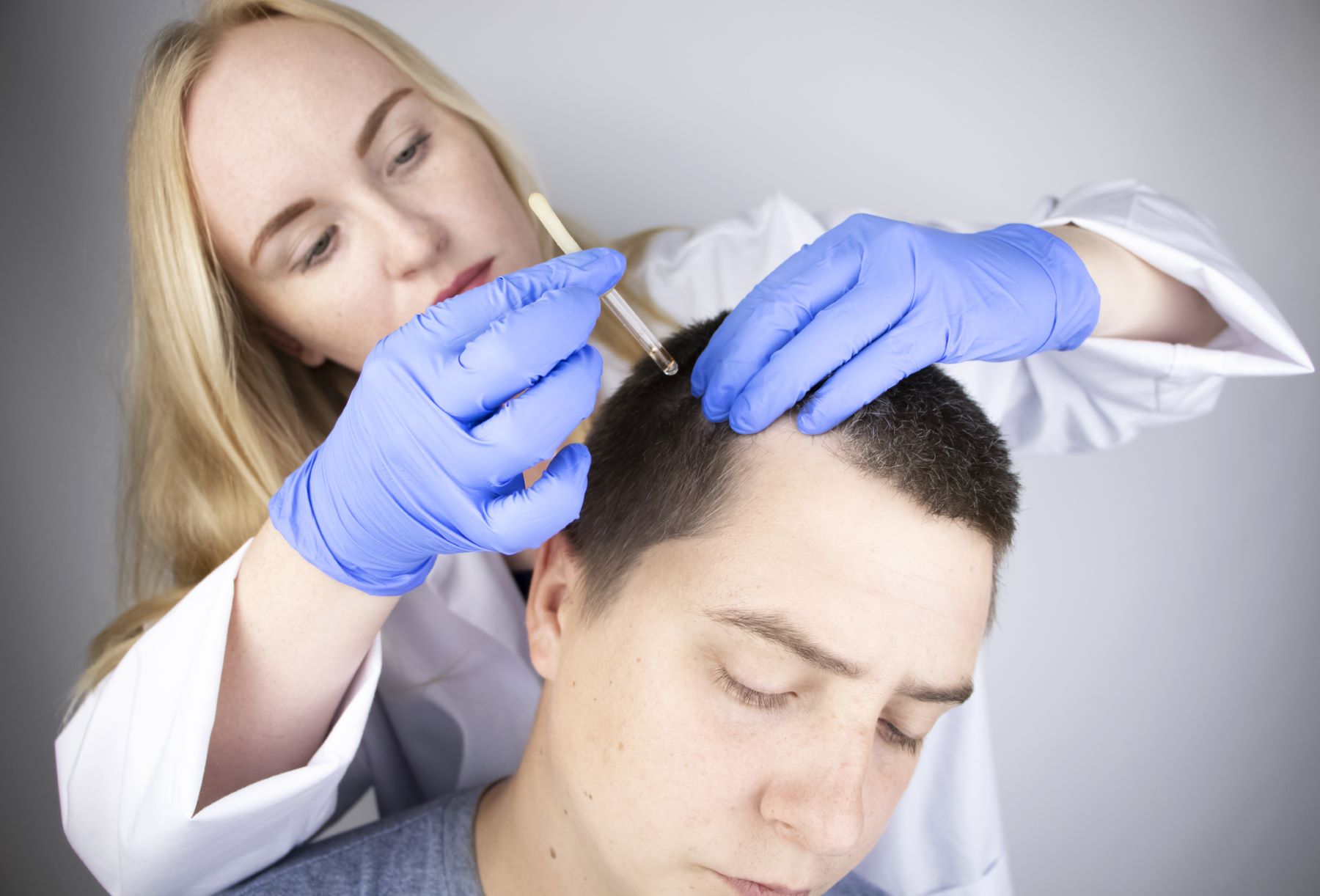 Hair doctor treating male pattern hair loss